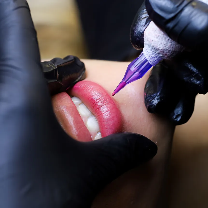 Lip blush session: pigment worked into the lip under topical anesthetic